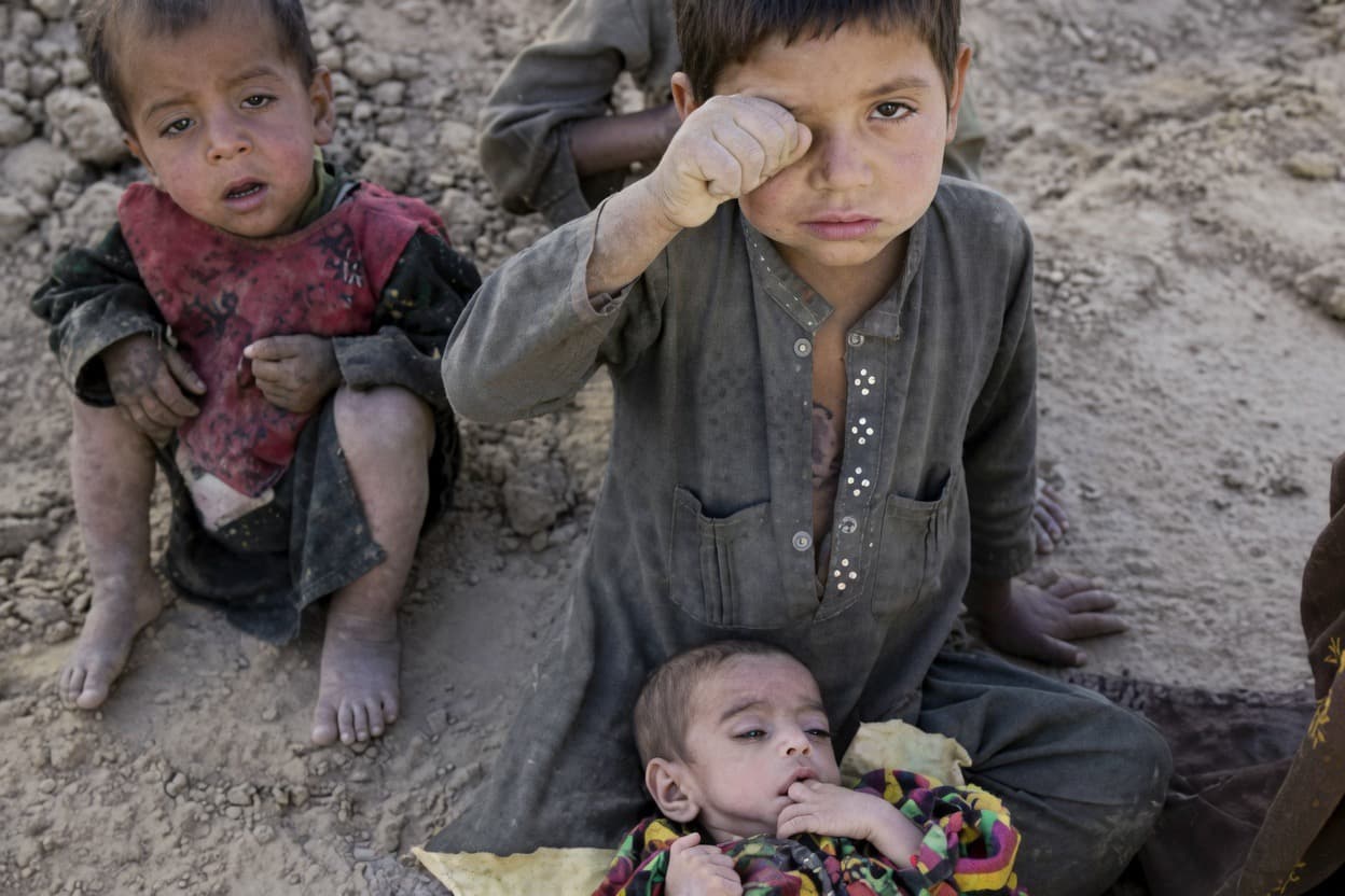 United Nations: 3.7 million Afghan children are facing the risk of severe malnutrition.