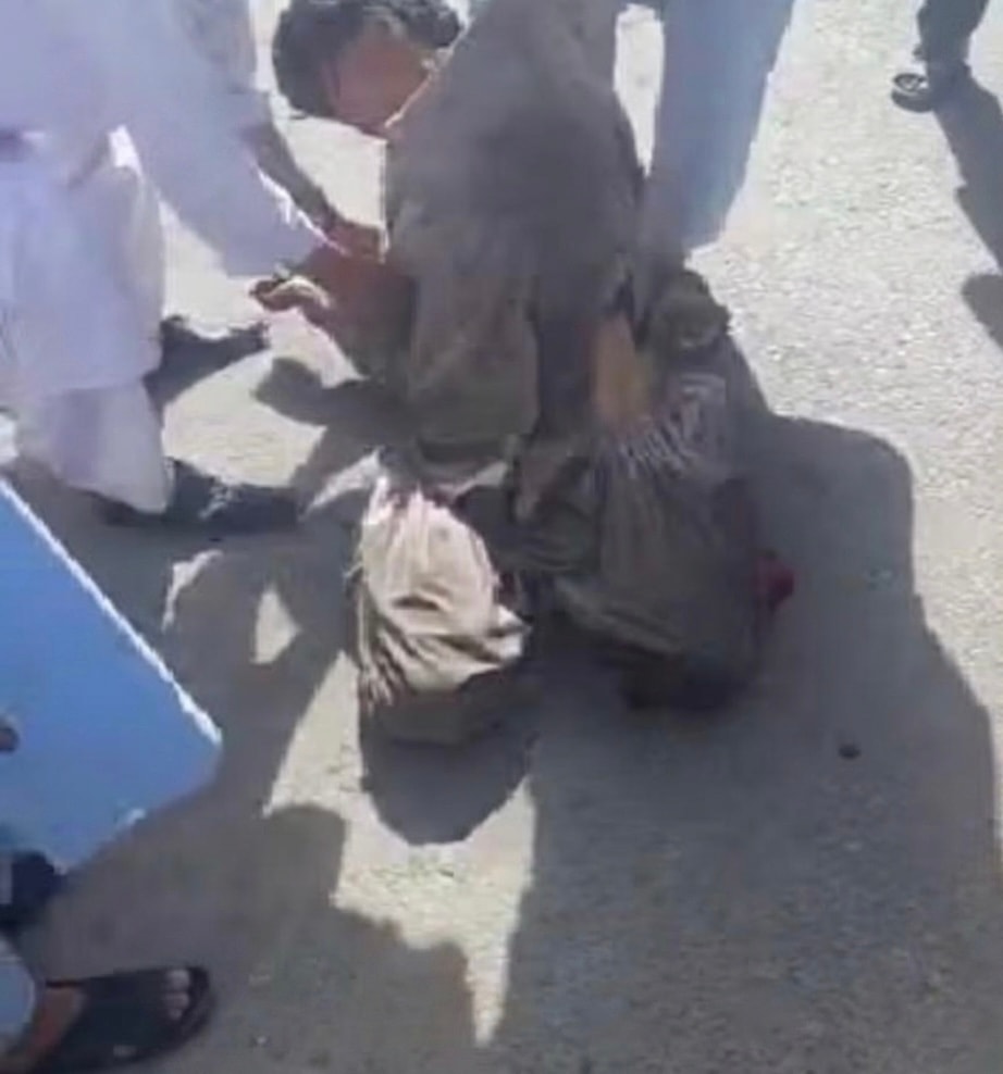 A child injured by Taliban gunfire during protests in Herat.