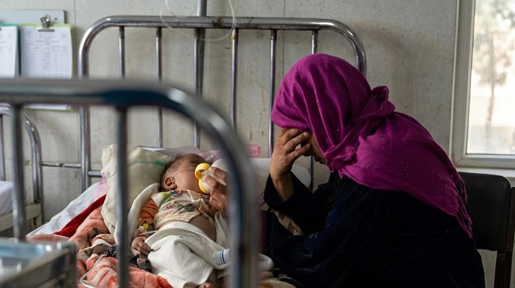 Malnutrition is on the rise in 53 percent of areas across Afghanistan.